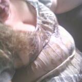Kathi from Glenwood Springs | Woman | 37 years old | Cancer