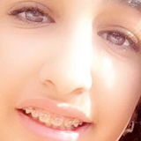 Loull from Kuwait | Woman | 30 years old | Cancer
