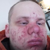 Lorentzensvf from Kolding | Man | 30 years old | Cancer